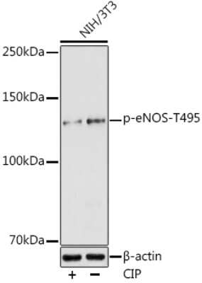 Western Blot: eNOS [p Thr495] Antibody [NBP3-05410] - Western blot analysis of extracts of NIH/3T3 cells, using eNOS antibody (NBP3-05410) at 1:1000 dilution.NIH/3T3 cells were treated by CIP(20uL/400ul) at 37C for 1 hour. Secondary antibody: HRP Goat Anti-Rabbit IgG (H+L) at 1:10000 dilution. Lysates/proteins: 25ug per lane. Blocking buffer: 3% nonfat dry milk in TBST. Detection: ECL Enhanced Kit. Exposure time: 180s.